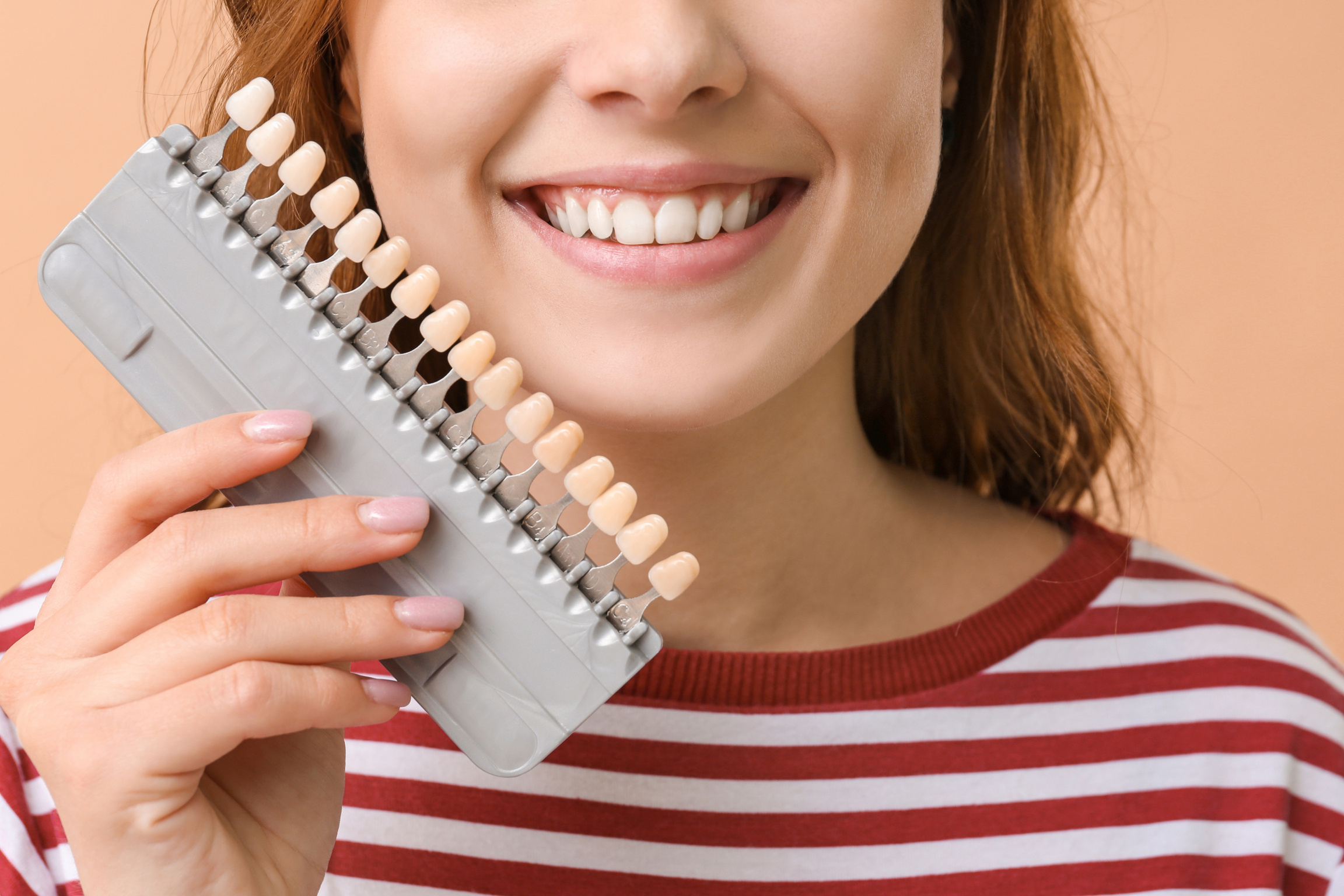 Woman with Veneers